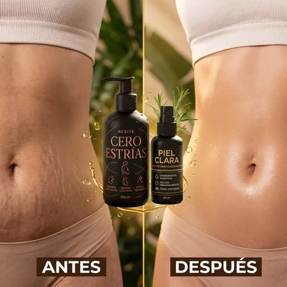 Aceite corporal Cero Estrías Splash para piel clara, ideal para hidratación diaria, piel más lisa y apariencia de tono uniforme.