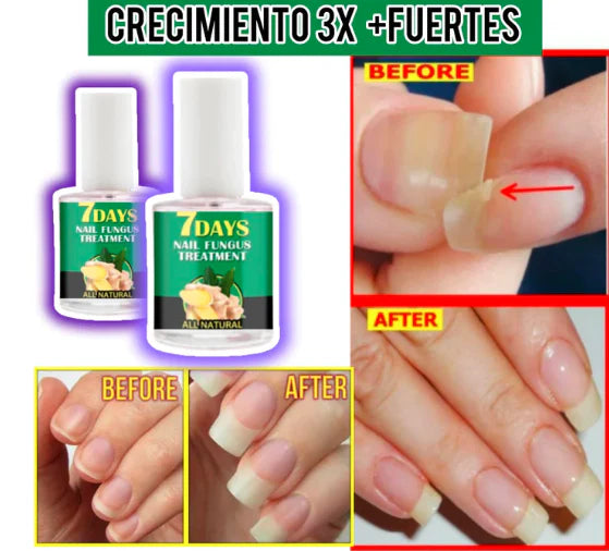 Serum fortalecedor de uñas que ayuda a mejorar su apariencia, resistencia y crecimiento con uso diario y aplicación nocturna.
